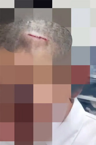 頭や首などから出血する寮生のA君