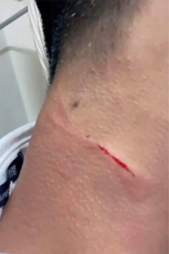 首を絞められることもあったという寮生B君