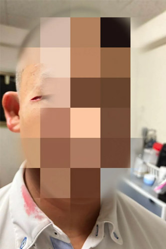 前寮長に至近距離からステンレス製のコップを投げつけられ、目元をケガした寮生